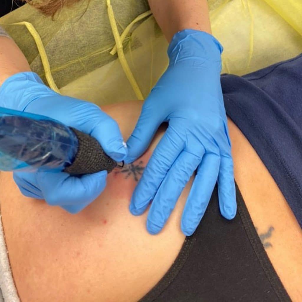 NonLaser Tattoo Removal Noggin Master Studio